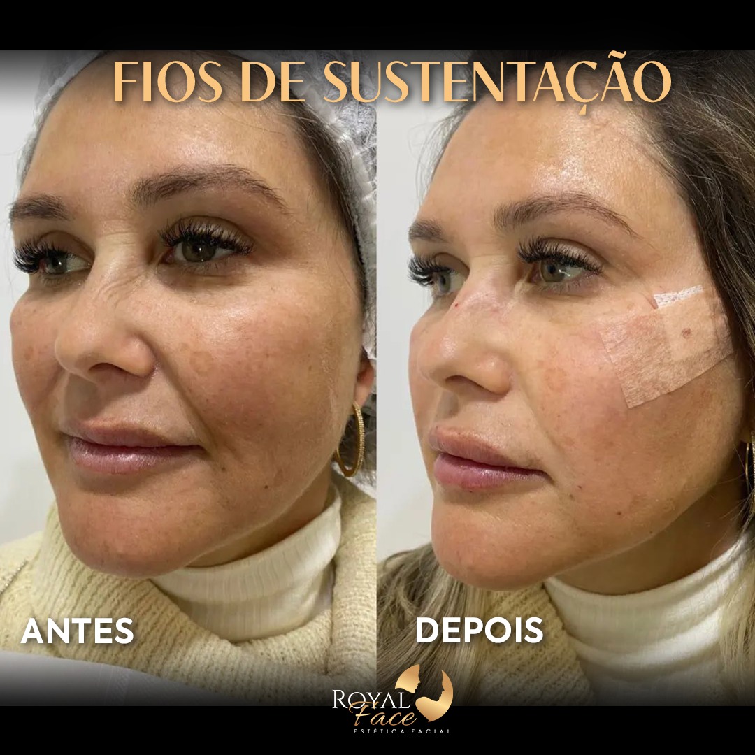 Procedimento 20
